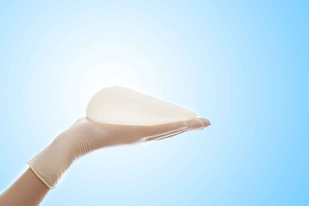 Screening---Breast-Implant